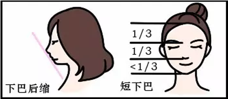 下巴后縮動(dòng)畫示例—韓國灰姑娘醫(yī)院—<!--<i data=20240703-sp></i>--><!--<i data=20240703-sp></i>-->