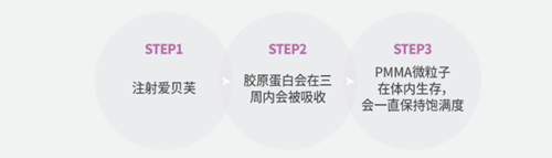 愛貝芙玻尿酸注射方法