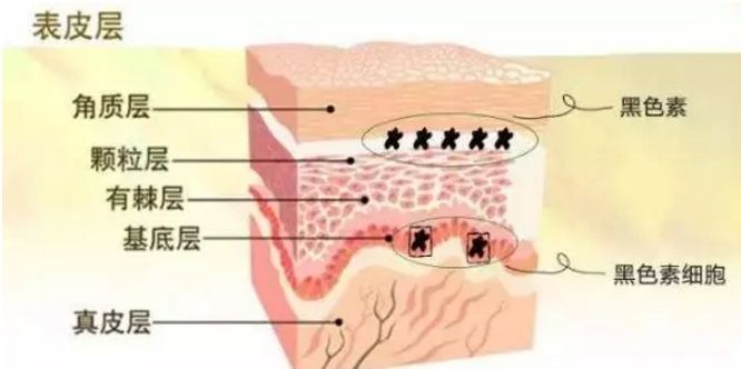 激光祛斑反黑怎么辦