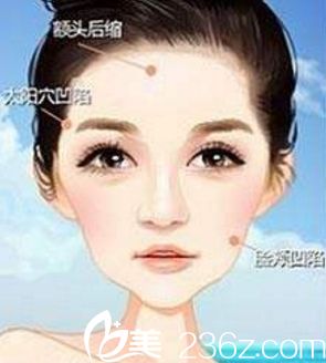 面部凹陷 脂肪面部填充