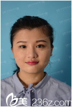 20171011_1507708610503101.png 1-1G0111115195P.png