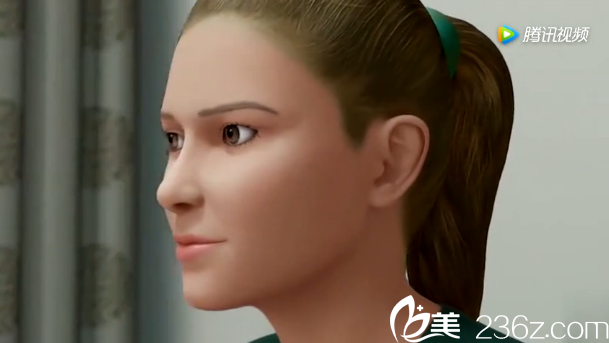 韓國(guó)will醫(yī)院鼻子矯正效果