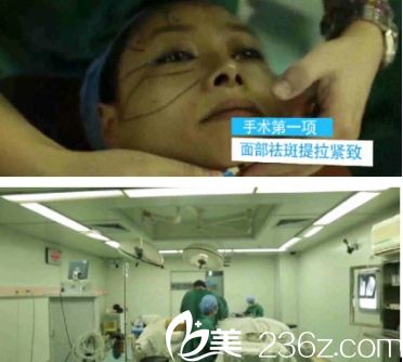 廣州華美易陽亮做激光美白手術中