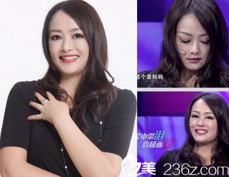 廣州華美易陽亮做激光美白手術后的照片2