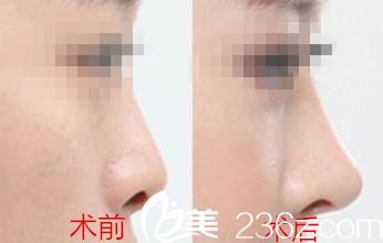 will醫(yī)院魏亨坤院長手術(shù)案例