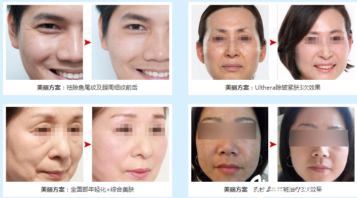 楊敏醫(yī)生整形案例 楊敏醫(yī)生整形案例