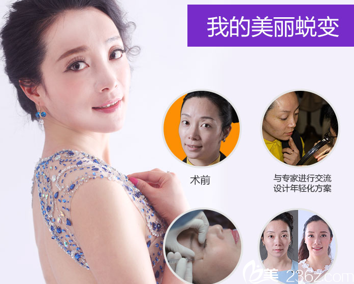 北京米蘭柏羽麗都醫(yī)療美容醫(yī)院曹令醫(yī)生面部年輕化<span style=