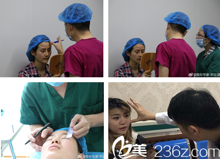 鐘正強(qiáng)為患者進(jìn)行面診、術(shù)前設(shè)計(jì)