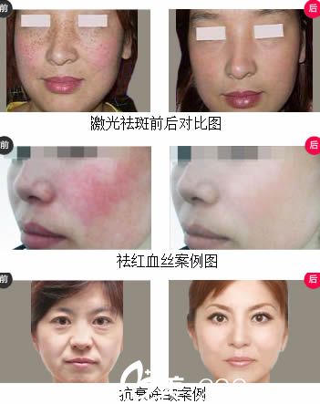 徐麗珍主任整形案例圖