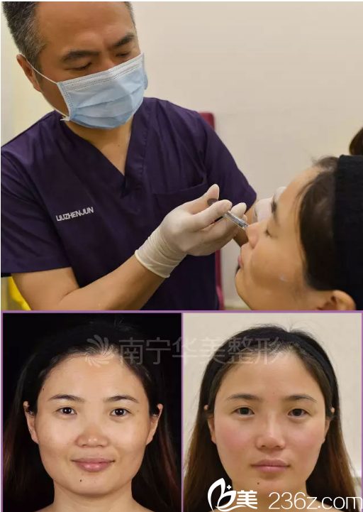 劉真俊院長面部注射現(xiàn)場 劉真俊院長面部注射現(xiàn)場