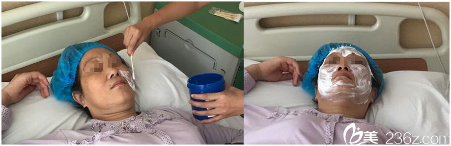 面部提升敷麻藥過程 面部提升敷麻藥過程