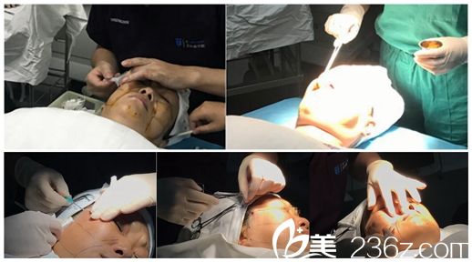 埋線提升消毒以及手術(shù)過程中 埋線提升消毒以及手術(shù)過程中