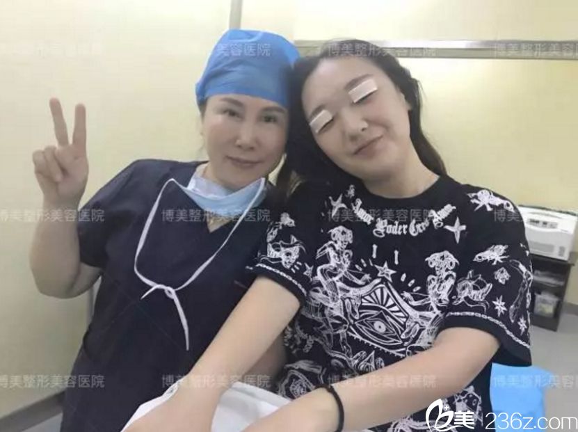 雙眼皮前后對比 永州博美