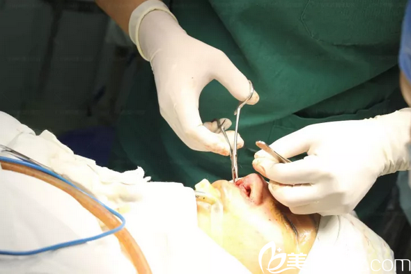 李希軍院長鼻修復(fù)傷口縫合過程 李希軍院長鼻修復(fù)傷口縫合過程