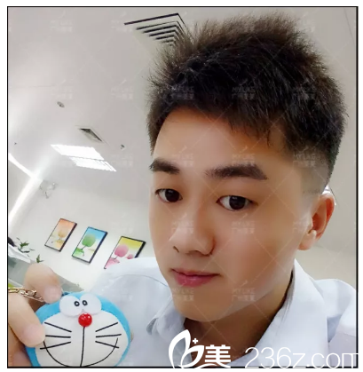 雙眼皮術(shù)前自拍 雙眼皮術(shù)前自拍