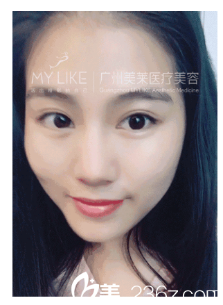 雙眼皮美女的自拍 雙眼皮美女的自拍