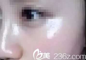 第二次注射的作用