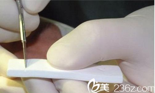  膨體雕刻 膨體隆鼻好還是硅膠 