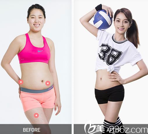 牙齦女樸童熙整形前后對比圖