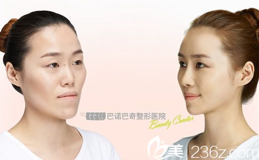 歌手韓雪熙在巴諾巴奇的蛻變故事