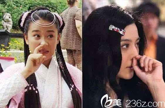 隆鼻后能挖鼻屎?jiǎn)犴n國(guó)will醫(yī)院魏亨坤院長(zhǎng)為您解答