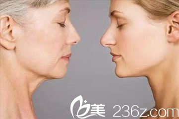 早線雕與晚線雕的區(qū)別