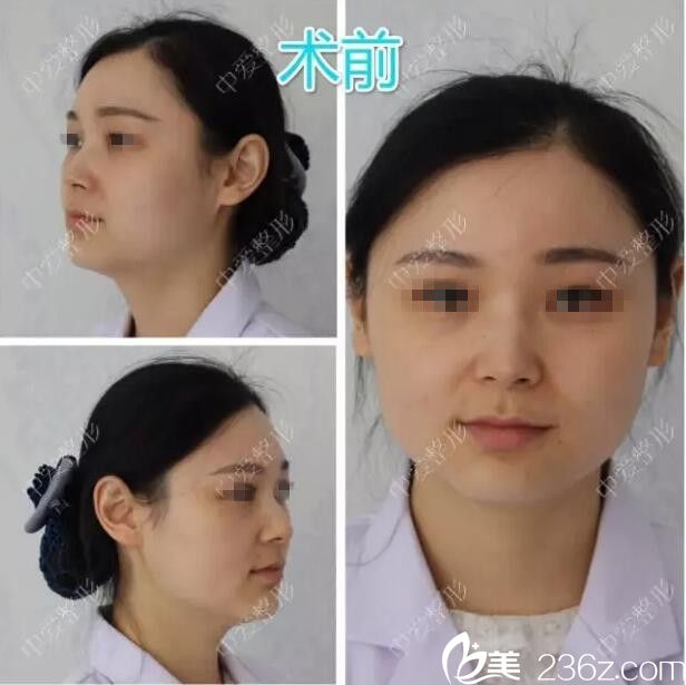 拍攝術(shù)前照片備案 拍攝術(shù)前照片備案