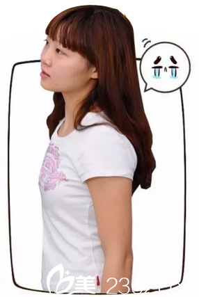 深圳美萊醫(yī)療美容醫(yī)院郭杰術(shù)前照片1