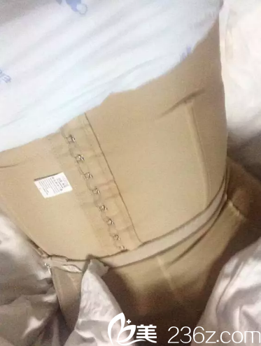 吸脂手術(shù)7天后要穿塑身衣
