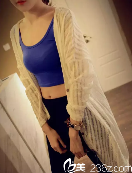 大腹婆在邯鄲都市整形醫(yī)院腰腹吸脂后炫妖嬈小蠻腰