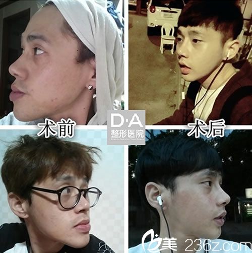 <!--<i data=20240703-sp></i>-->院長(zhǎng)的面部輪廓案例 <!--<i data=20240703-sp></i>-->院長(zhǎng)的面部輪廓案例