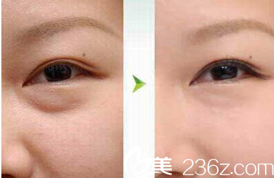 紫潔儷方(北京)醫(yī)療美容診所案例 紫潔儷方(北京)醫(yī)療美容診所案例