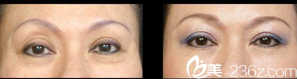 紫潔儷方(北京)醫(yī)療美容診所案例 紫潔儷方(北京)醫(yī)療美容診所案例