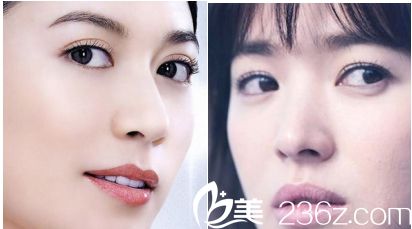 青島壹美做雙眼皮怎么樣？