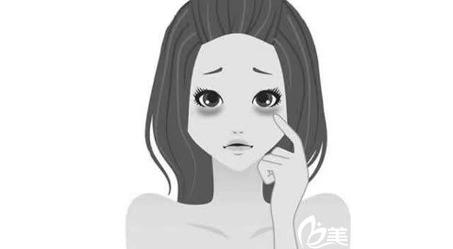 黑眼圈