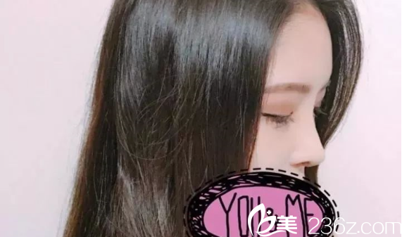 南京維多利亞隆鼻開眼角術(shù)后2周