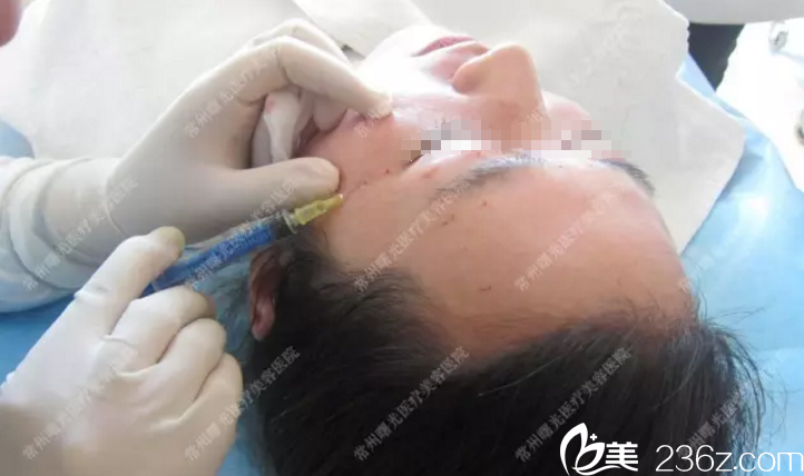 注射過程 注射過程