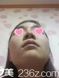 鼻子形態(tài)不好看 鼻子形態(tài)不好看