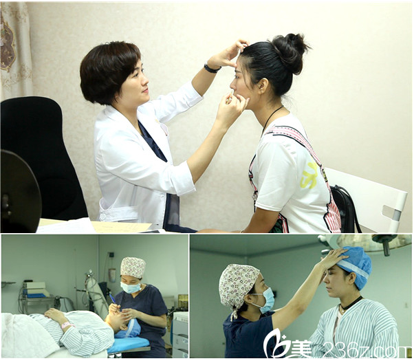 廣州華美阮慶玲雙眼皮手術過程圖 廣州華美阮慶玲雙眼皮手術過程圖