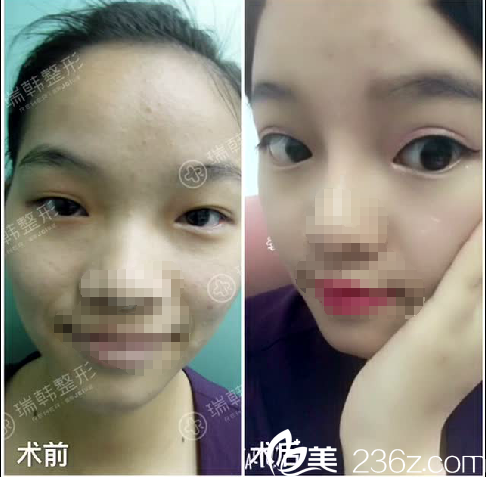 20171115_1510732554824549.png image.png