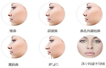 隆鼻只是單純改變鼻子的形態(tài)？