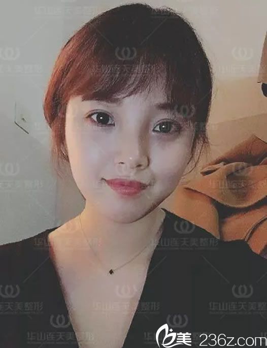 瘦臉一周的變化效果 瘦臉一周的變化效果