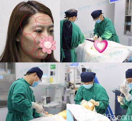 在海南瑞韓做面部脂肪填充面診及手術(shù)過程 在海南瑞韓做面部脂肪填充面診及手術(shù)過程