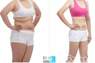 張凱吸脂案例 張凱吸脂案例