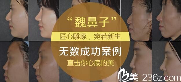 韓國(guó)will魏亨坤手術(shù)案例