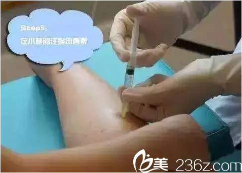 瘦腿瘦腿注射