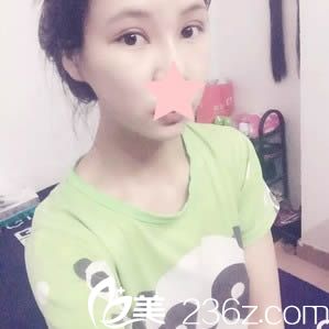 盛宗順做眼睛術(shù)后15天恢復(fù)效果 盛宗順做眼睛術(shù)后15天恢復(fù)效果