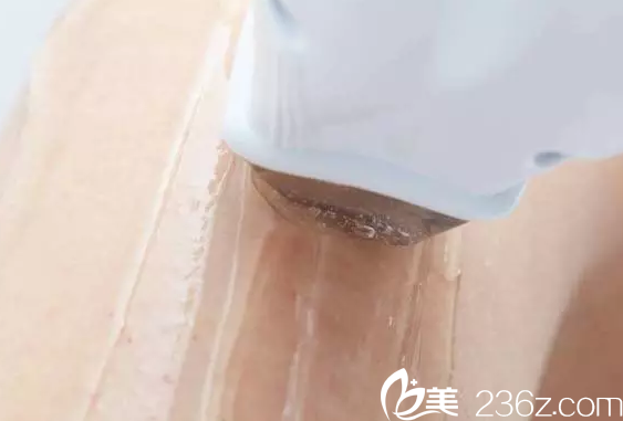 激光脫毛涂冷凝膠過程 激光脫毛涂冷凝膠過程