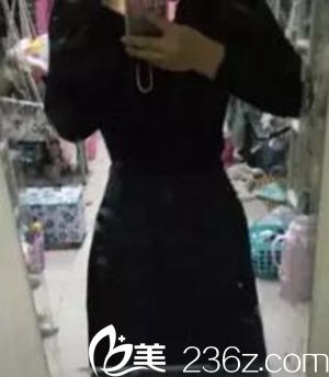 分享我在沈陽茗湲做腰腹吸脂手術(shù)后3個(gè)月恢復(fù)全過程