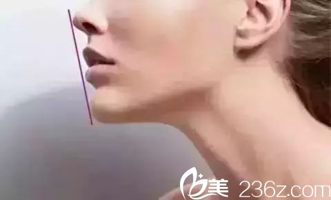 嘴唇自然緊閉，鼻尖唇珠下巴在一條線上